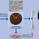 Regenerative Repair of Bone Defects with Osteoinductive Hydroxyapatite Fabricated to Match the Defect and Implanted with CAD, CAM, and Computer-Assisted Surgery Systems.