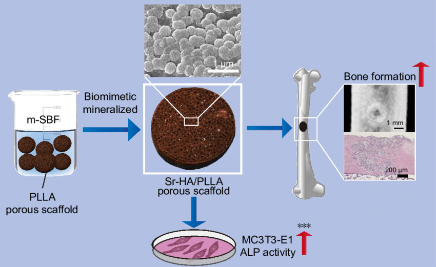 Regenerative Repair of Bone Defects with Osteoinductive Hydroxyapatite Fabricated to Match the Defect and Implanted with CAD, CAM, and Computer-Assisted Surgery Systems.