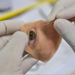 Colour Image Reproduction for 3D Printing Facial Prosthese