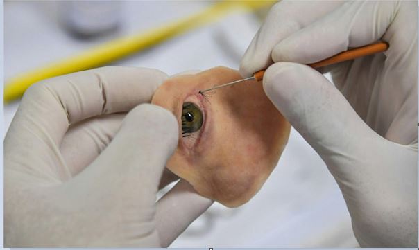 Colour Image Reproduction for 3D Printing Facial Prosthese