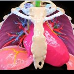 3D Printing Cardiovascular Anatomy: A Single-Centre Experience